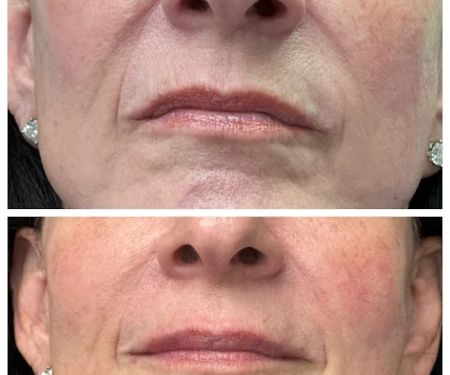 South Florida Aesthetics