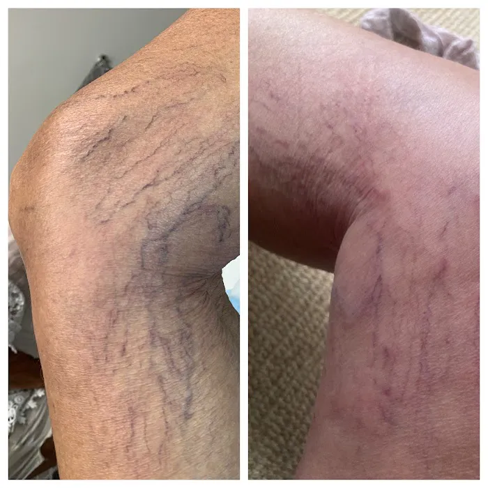 South Florida Aesthetics Picture 8