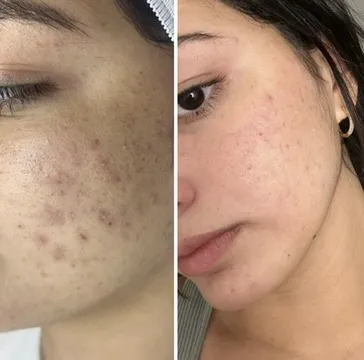 Serenity Skin by Sam Picture 3