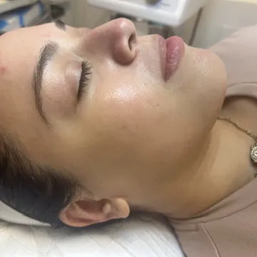 Serenity Skin by Sam Picture 2