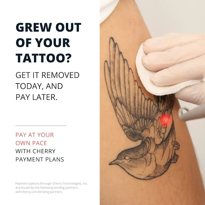 Erase Ink Laser Tattoo Removal Picture 8