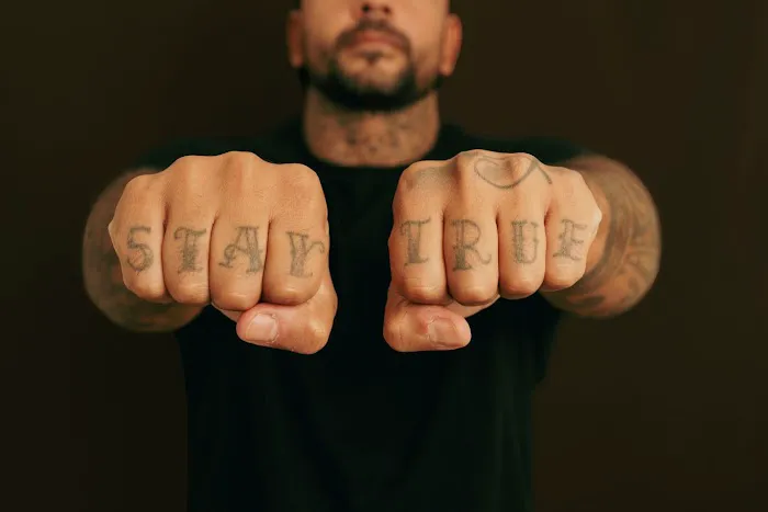 Erase Ink Laser Tattoo Removal Picture 5