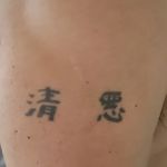 Erase Ink Laser Tattoo Removal