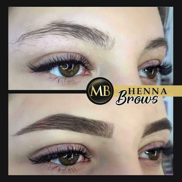 MB Medical Aesthetics Picture 7