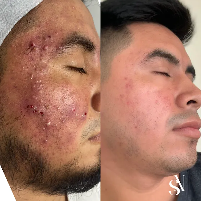 New Skin By Sandra Chica Picture 4