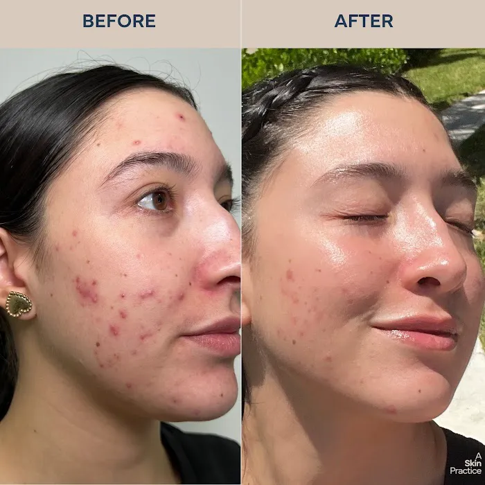 A skin practice Picture 7