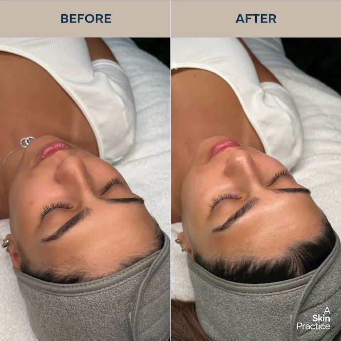 A skin practice Picture 8