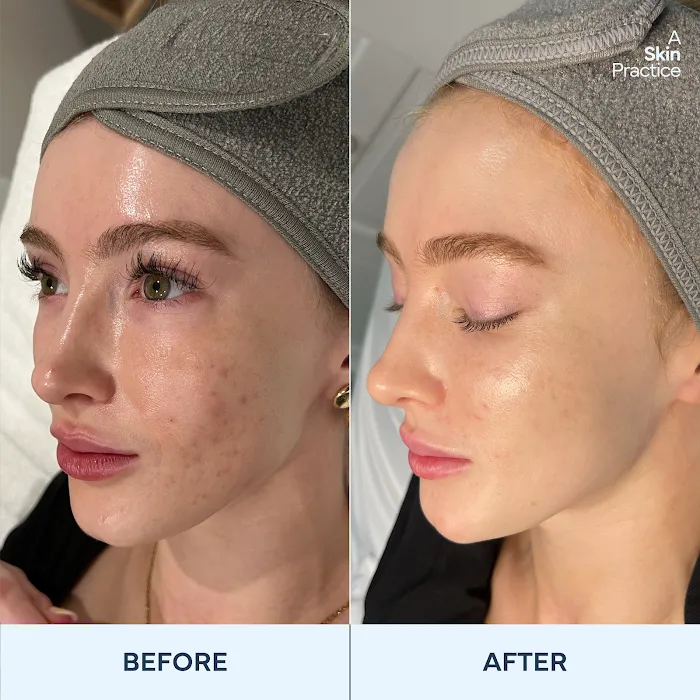 A skin practice Picture 9