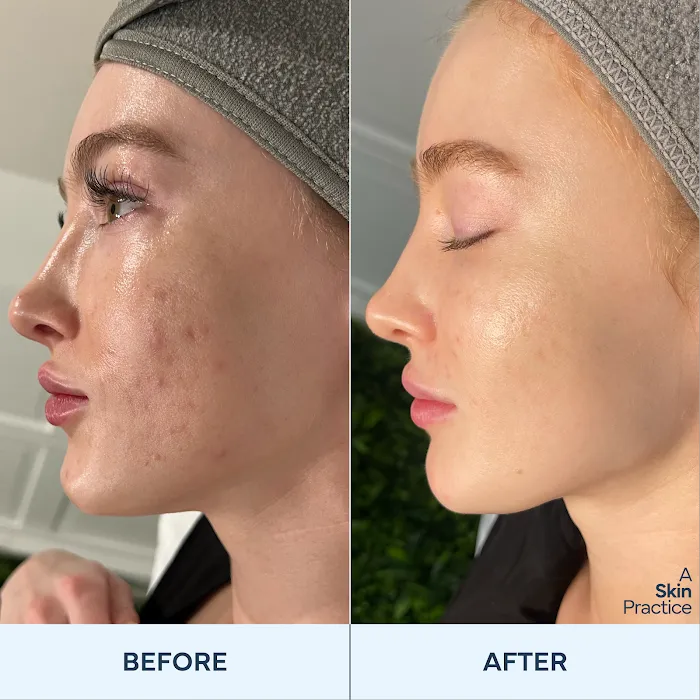 A skin practice Picture 10