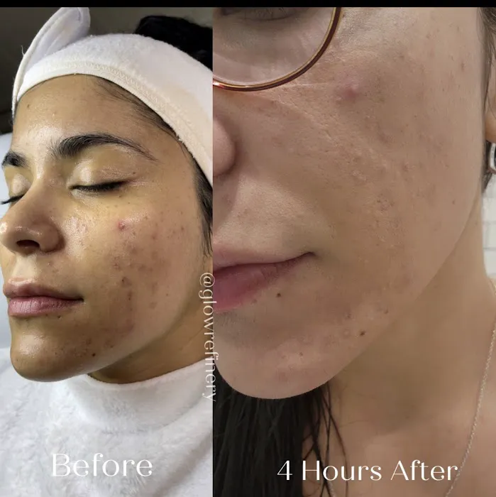 Glow Refinery Picture 9