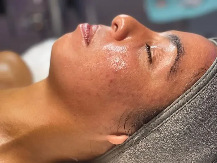 Glow Refinery Picture 4