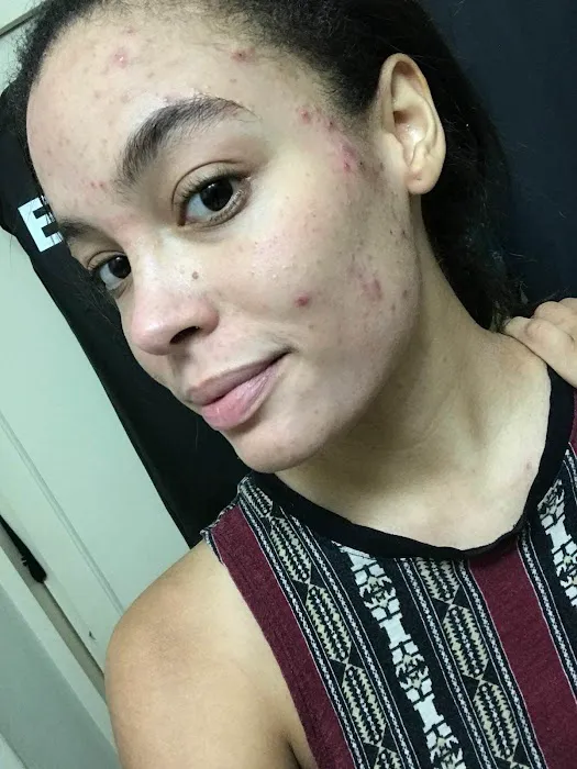 Pines Skincare and Detox Spa Picture 1