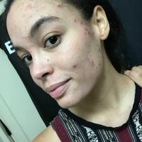 Pines Skincare and Detox Spa ico