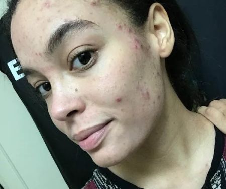 Pines Skincare and Detox Spa