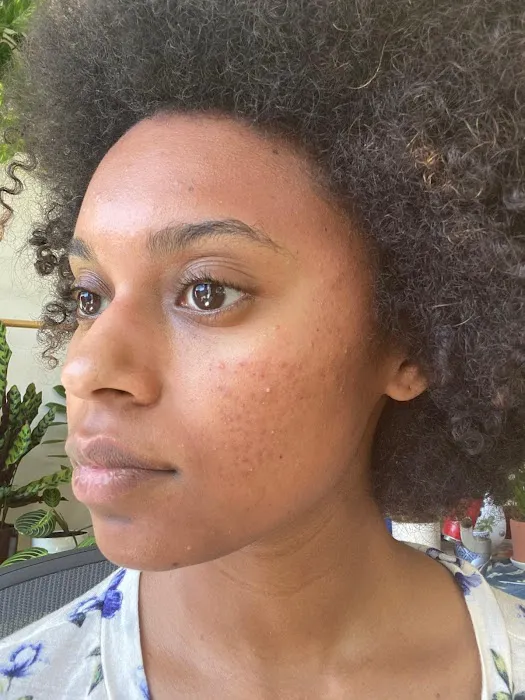 Pines Skincare and Detox Spa Picture 2