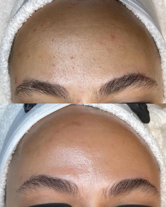 Pines Skincare and Detox Spa Picture 4