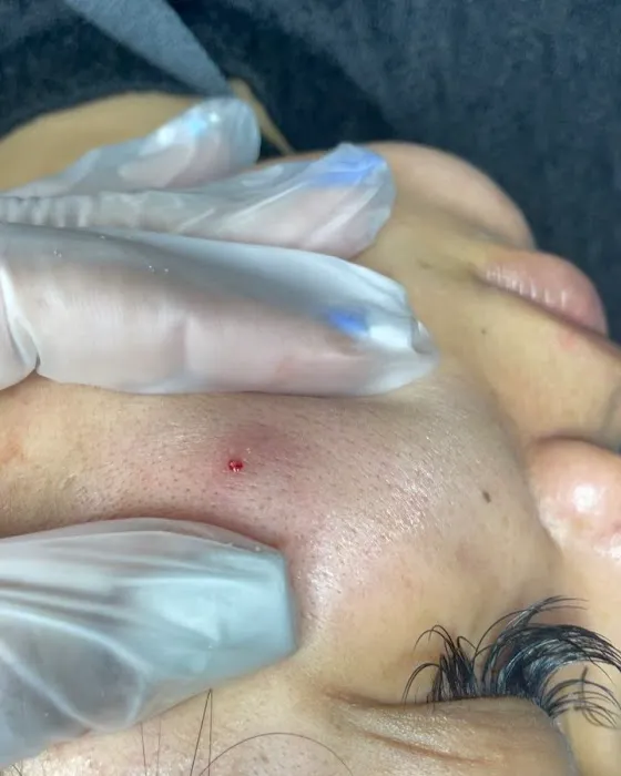 Lisa Seyz Skin Care Picture 4