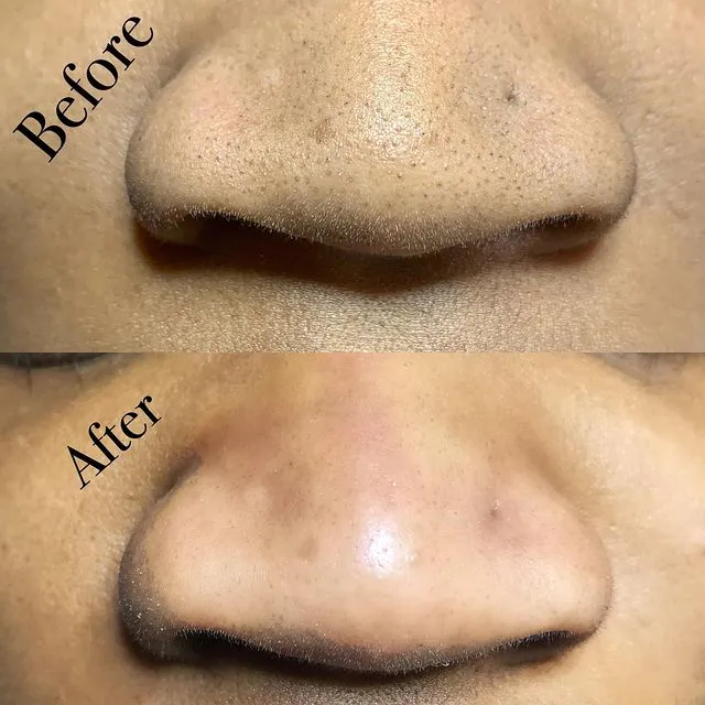 Lisa Seyz Skin Care Picture 9