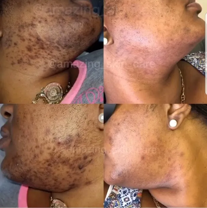 Amazing Skin Care Med Spa Picture 6