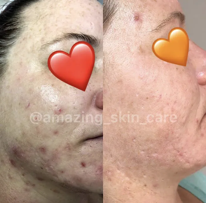 Amazing Skin Care Med Spa Picture 8