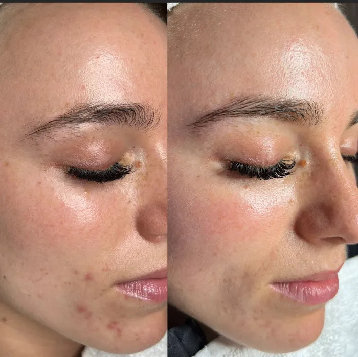 Aesthetic Skin & Wellness Solutions LLC Picture 6