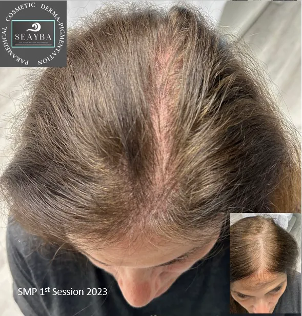 SEA Your Beauty Aesthetics (SEAYBA) Picture 7