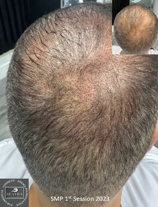 SEA Your Beauty Aesthetics (SEAYBA) Picture 9