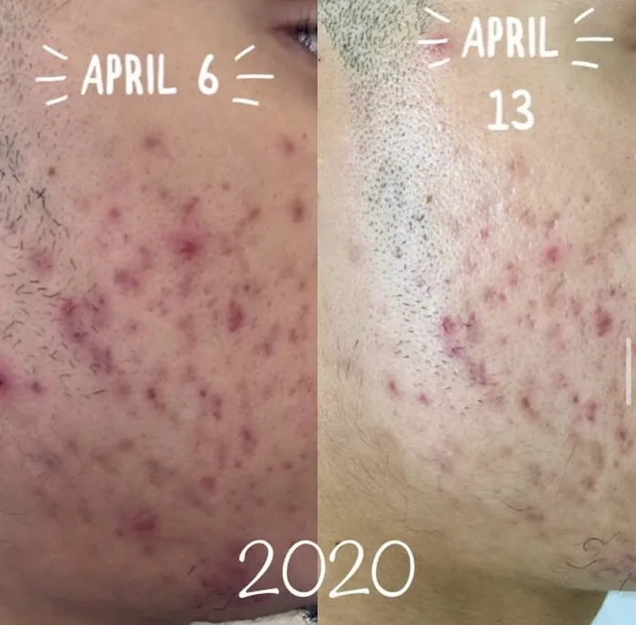 Skin and Ink Artistry Picture 9