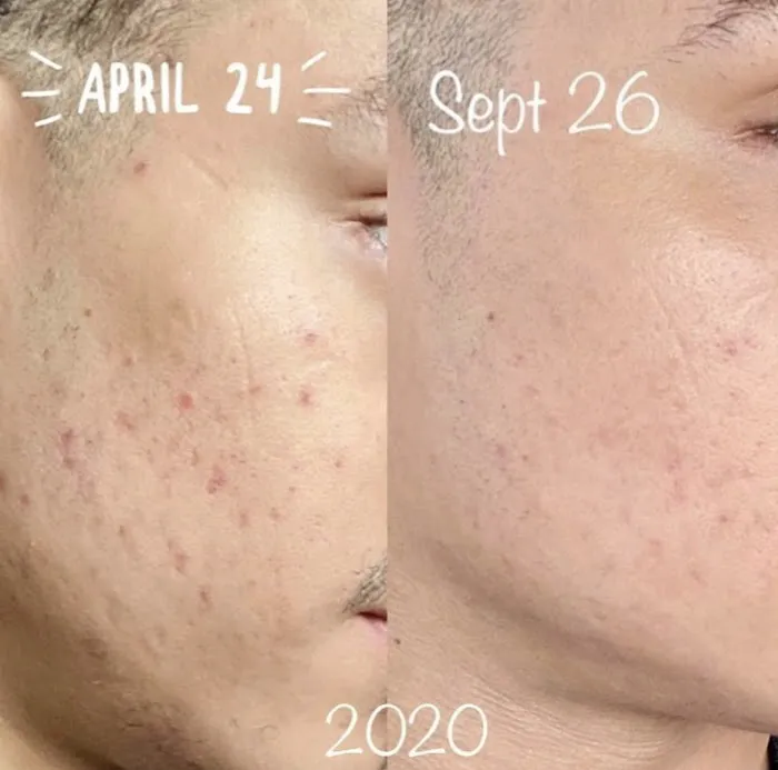 Skin and Ink Artistry Picture 7