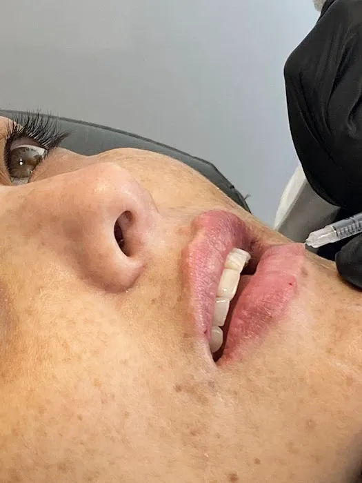 Be Beautiful Aesthetic Medicine Picture 4