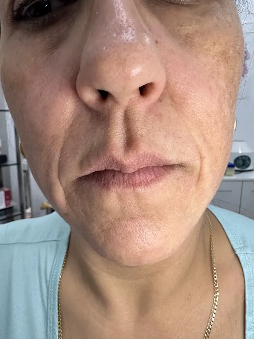 Doc Grace Aesthetics Picture 6