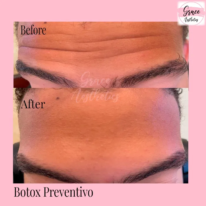 Doc Grace Aesthetics Picture 8