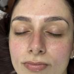 Doc Grace Aesthetics