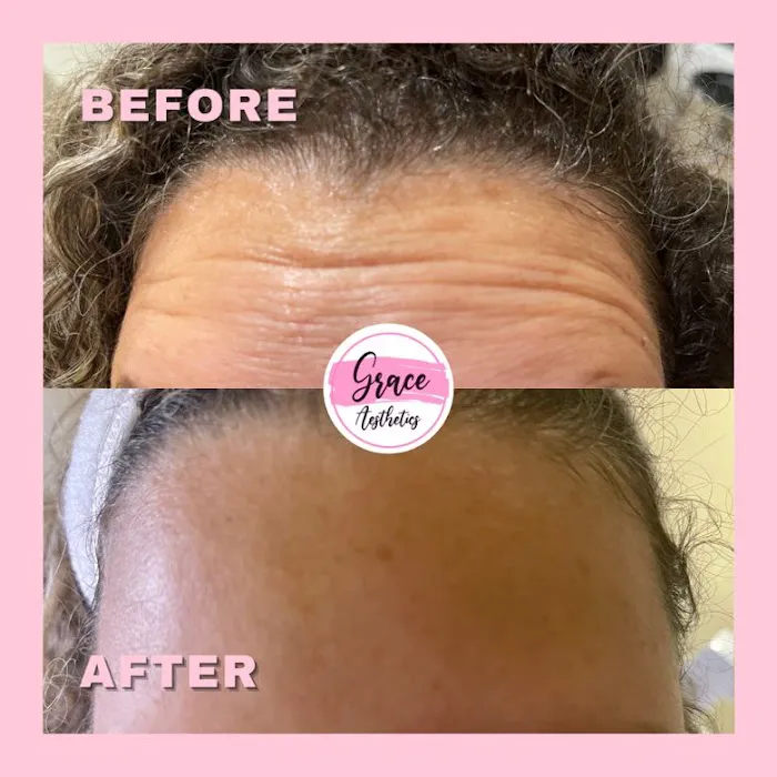 Doc Grace Aesthetics Picture 7