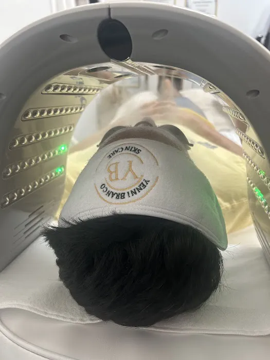 YB skin Care PMU Picture 4