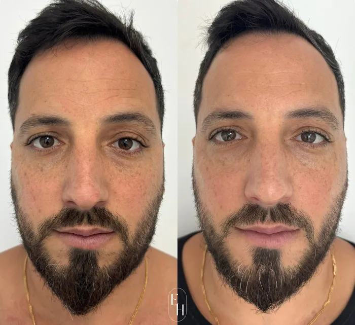 Everly Happy Picture 5