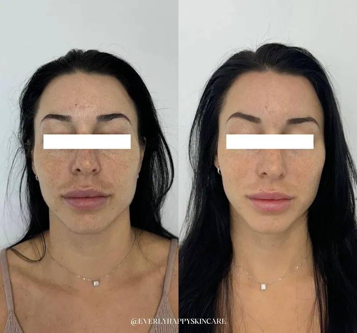 Everly Happy Picture 4