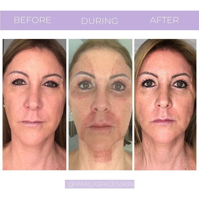 Yamila's Faces Skin Care - Hallandale Beach Picture 5