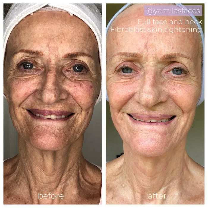 Yamila's Faces Skin Care - Hallandale Beach Picture 2