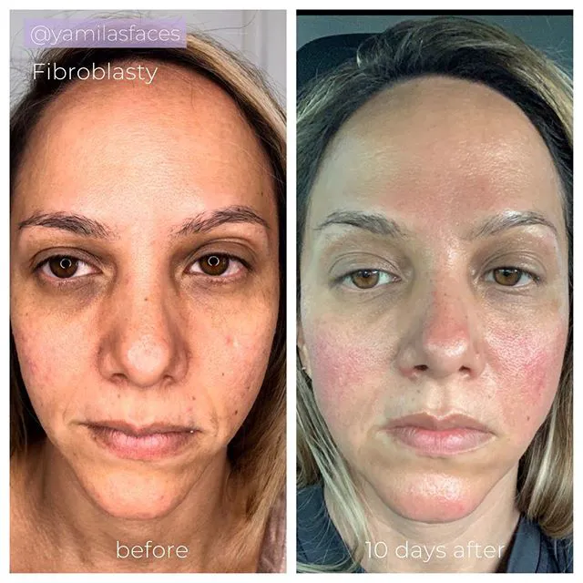 Yamila's Faces Skin Care - Hallandale Beach Picture 10