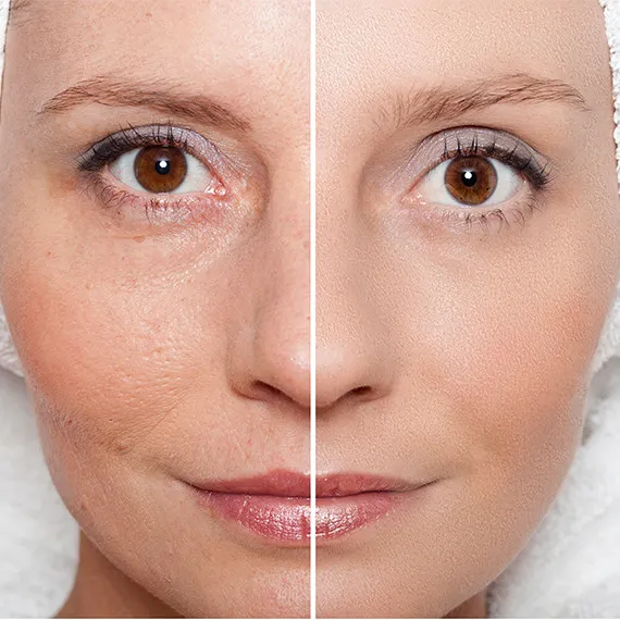 Yamila's Faces Skin Care - Hallandale Beach Picture 4