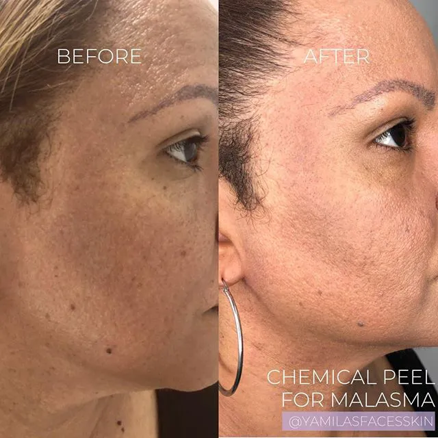 Yamila's Faces Skin Care - Hallandale Beach Picture 6