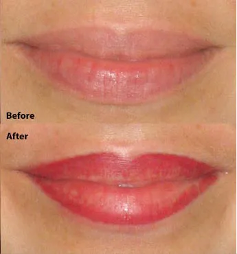 Denise Yopp Licensed Paramedical Esthetician/South Florida skin care systems Picture 4