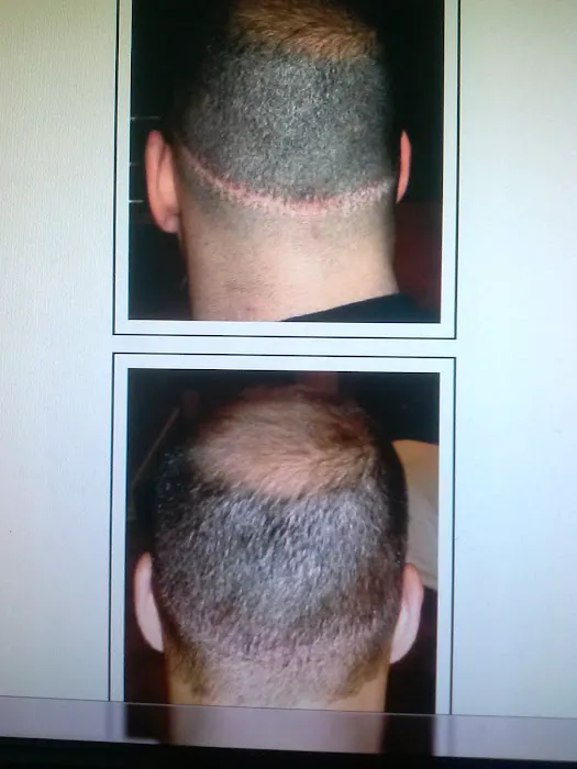 Denise Yopp Licensed Paramedical Esthetician/South Florida skin care systems Picture 1