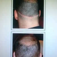 Denise Yopp Licensed Paramedical Esthetician/South Florida skin care systems ico