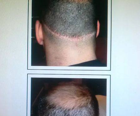 Denise Yopp Licensed Paramedical Esthetician/South Florida skin care systems