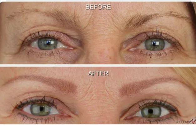 Denise Yopp Licensed Paramedical Esthetician/South Florida skin care systems Picture 2