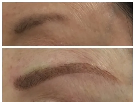 Denise Yopp Licensed Paramedical Esthetician/South Florida skin care systems Picture 8