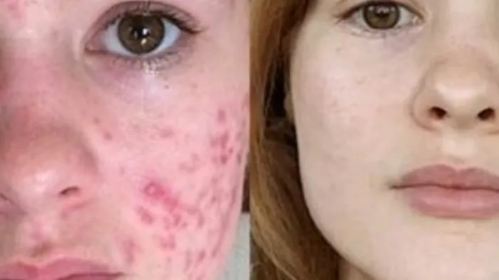 Denise Yopp Licensed Paramedical Esthetician/South Florida skin care systems Picture 9