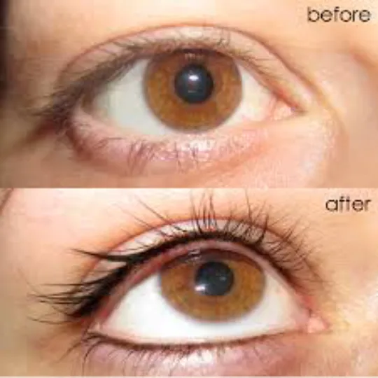 Denise Yopp Licensed Paramedical Esthetician/South Florida skin care systems Picture 3